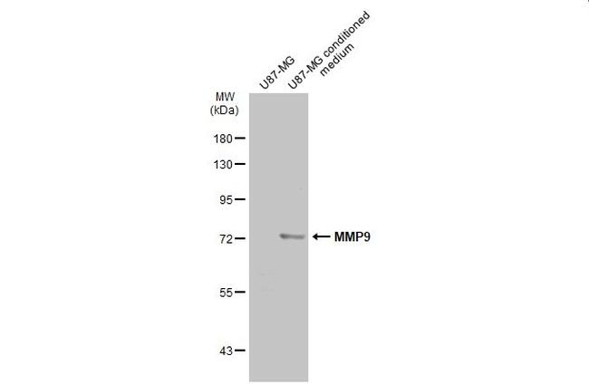 MMP9 Antibody in Western Blot (WB)