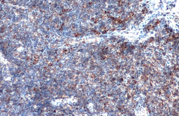 MMP9 Antibody in Immunohistochemistry (Paraffin) (IHC (P))