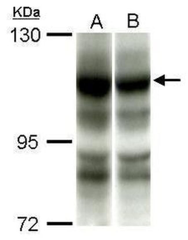 PIK3CA Antibody in Western Blot (WB)