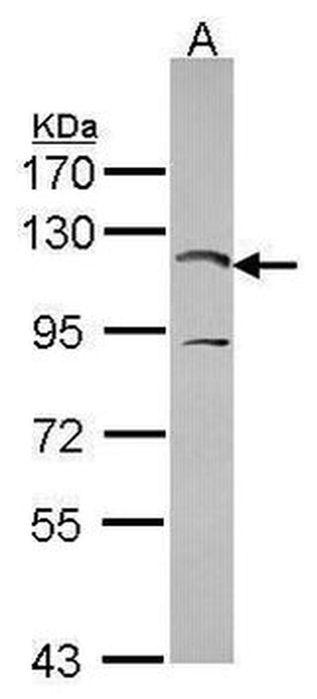 PIK3CA Antibody in Western Blot (WB)