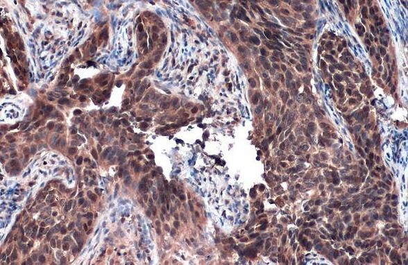 RAD51 Antibody in Immunohistochemistry (Paraffin) (IHC (P))