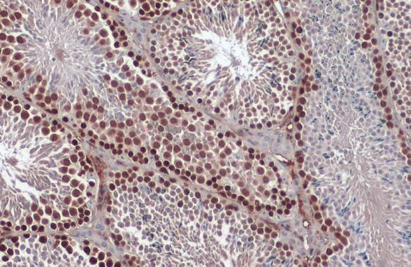 RAD51 Antibody in Immunohistochemistry (Paraffin) (IHC (P))