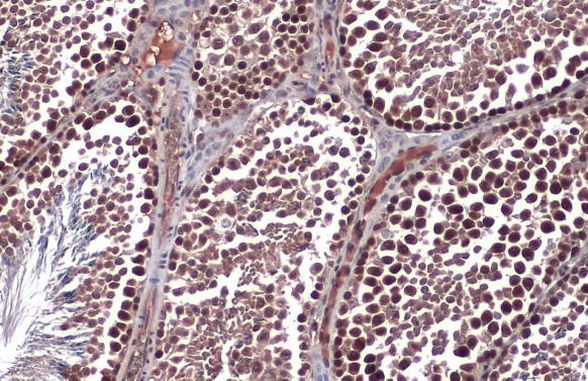 RAD51 Antibody in Immunohistochemistry (Paraffin) (IHC (P))