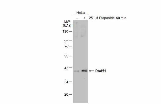 RAD51 Antibody in Western Blot (WB)