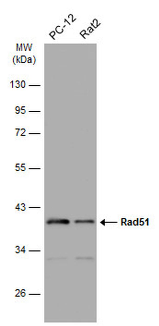 RAD51 Antibody in Western Blot (WB)