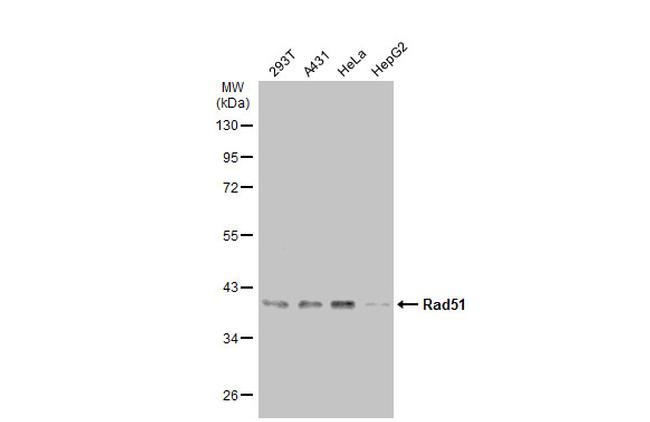 RAD51 Antibody in Western Blot (WB)