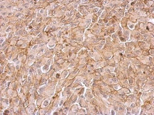 Maspin Antibody in Immunohistochemistry (Paraffin) (IHC (P))