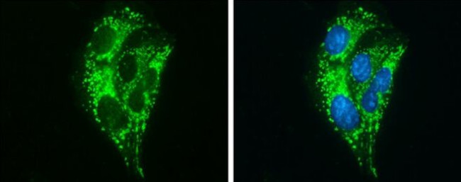 ABAT Antibody in Immunocytochemistry (ICC/IF)