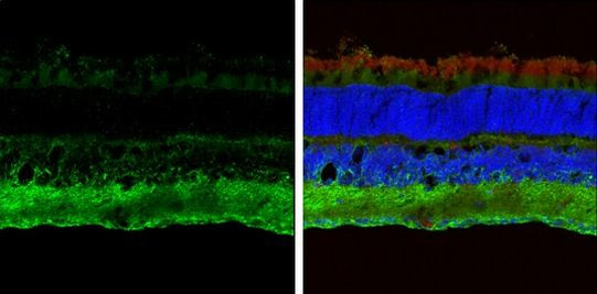 ABAT Antibody in Immunohistochemistry (Frozen) (IHC (F))