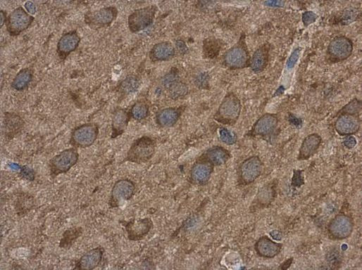 ABAT Antibody in Immunohistochemistry (Paraffin) (IHC (P))