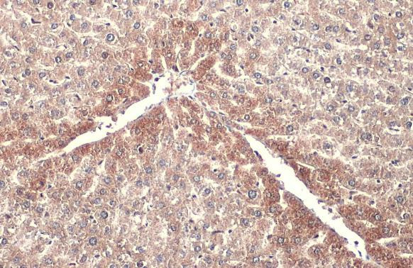 ABAT Antibody in Immunohistochemistry (Paraffin) (IHC (P))