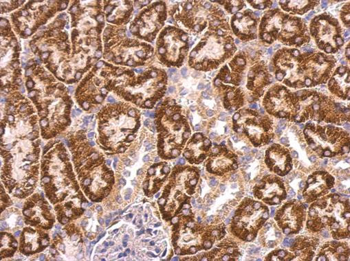 ABAT Antibody in Immunohistochemistry (Paraffin) (IHC (P))