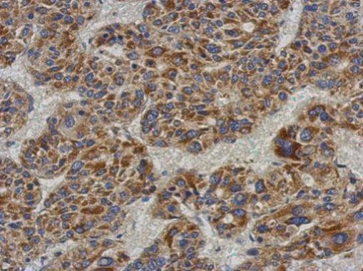 ACADL Antibody in Immunohistochemistry (Paraffin) (IHC (P))