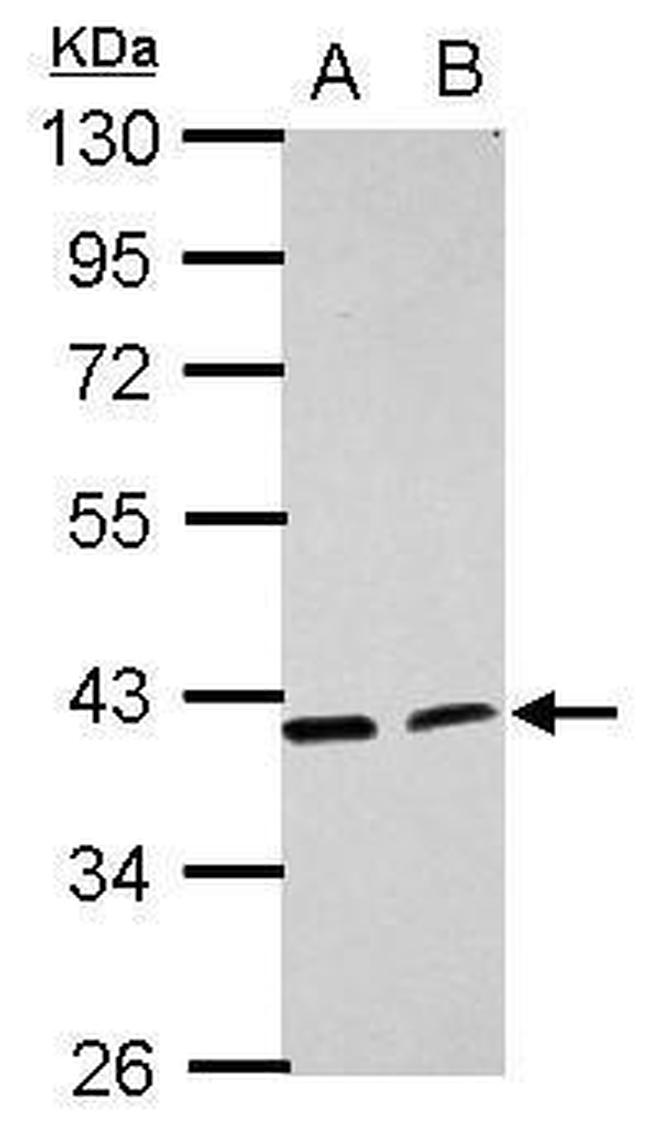 ACADL Antibody in Western Blot (WB)