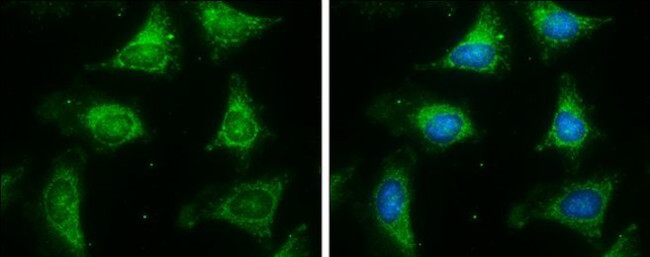 ACADM Antibody in Immunocytochemistry (ICC/IF)