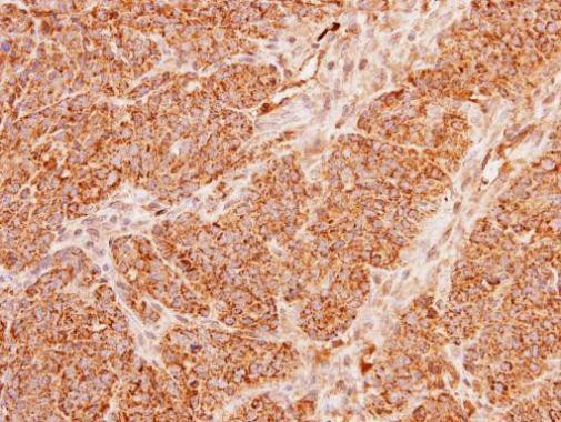 ACADM Antibody in Immunohistochemistry (Paraffin) (IHC (P))