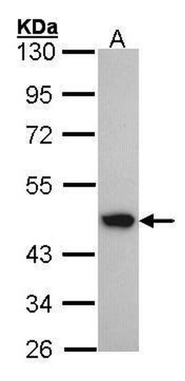 ACADM Antibody in Western Blot (WB)