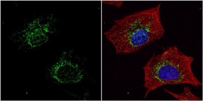 ACADM Antibody in Immunocytochemistry (ICC/IF)