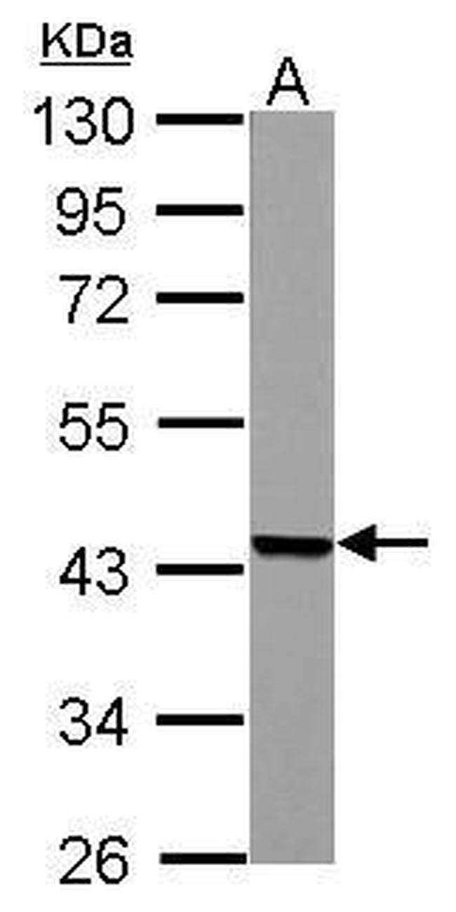 ACADM Antibody in Western Blot (WB)