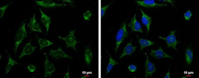 XIAP Antibody in Immunocytochemistry (ICC/IF)