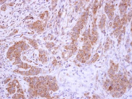 XIAP Antibody in Immunohistochemistry (Paraffin) (IHC (P))