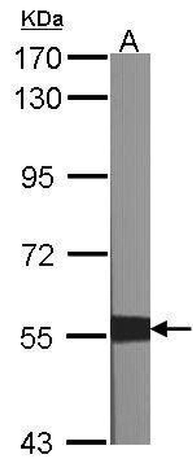 XIAP Antibody in Western Blot (WB)