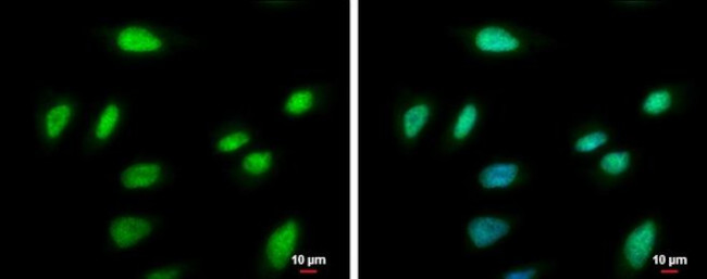 PCNA Antibody in Immunocytochemistry (ICC/IF)