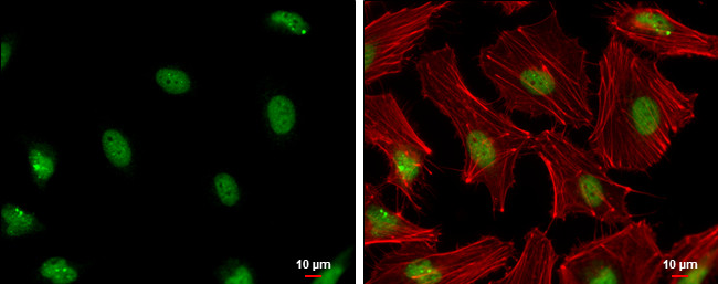 PCNA Antibody in Immunocytochemistry (ICC/IF)