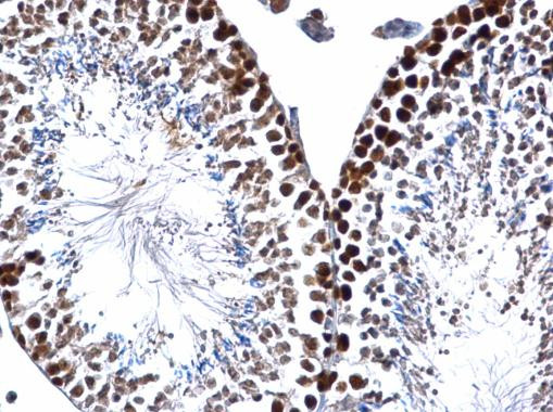 PCNA Antibody in Immunohistochemistry (Paraffin) (IHC (P))