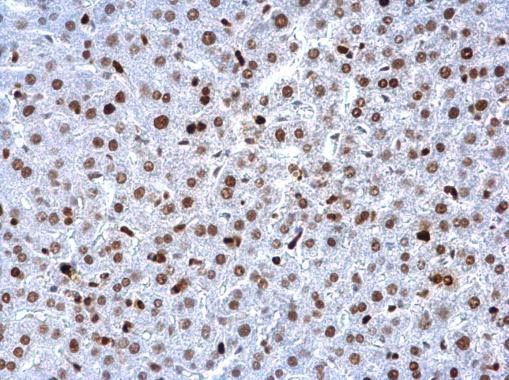 PCNA Antibody in Immunohistochemistry (Paraffin) (IHC (P))