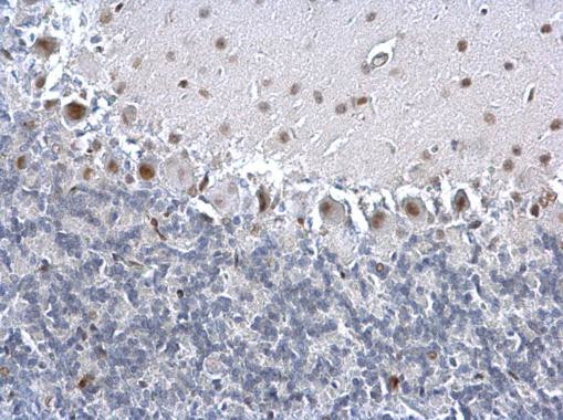 PCNA Antibody in Immunohistochemistry (Paraffin) (IHC (P))