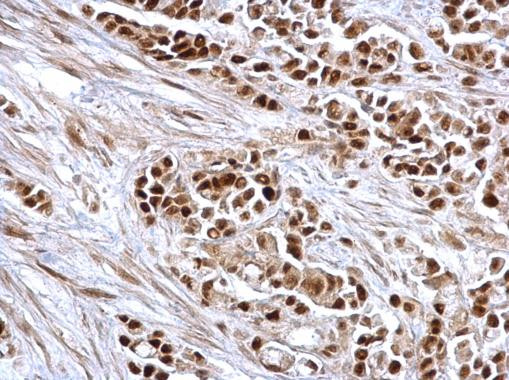 Rb Antibody in Immunohistochemistry (Paraffin) (IHC (P))