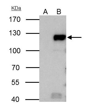 Rb Antibody in Immunoprecipitation (IP)