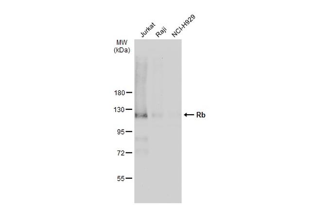 Rb Antibody in Western Blot (WB)