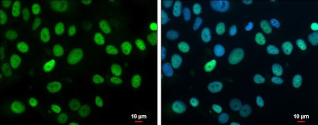 Rb Antibody in Immunocytochemistry (ICC/IF)