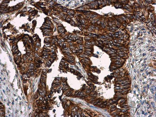 VCAM-1 Antibody in Immunohistochemistry (Paraffin) (IHC (P))