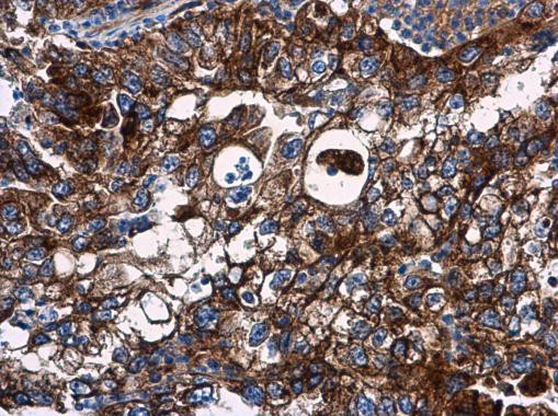 VCAM-1 Antibody in Immunohistochemistry (Paraffin) (IHC (P))