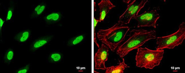 PARP1 Antibody in Immunocytochemistry (ICC/IF)