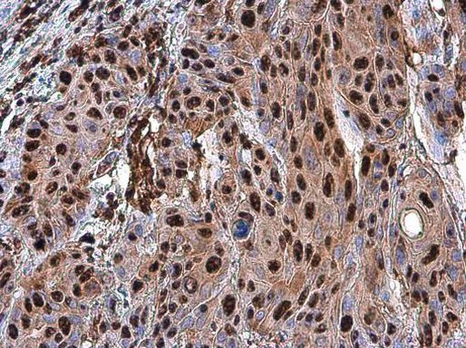 PARP1 Antibody in Immunohistochemistry (Paraffin) (IHC (P))