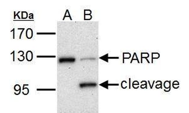 PARP1 Antibody in Western Blot (WB)