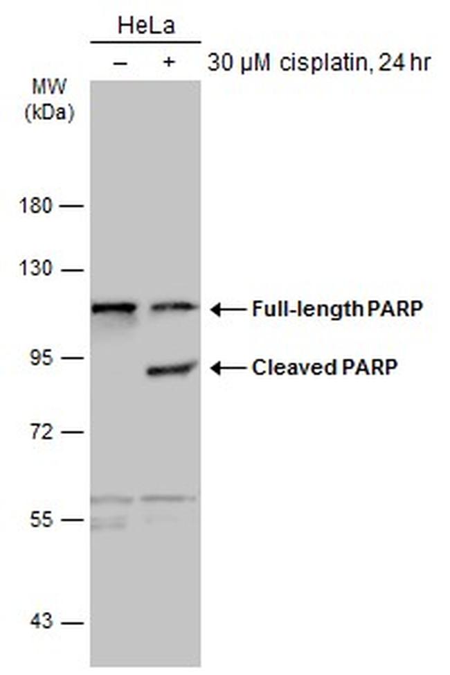 PARP1 Antibody in Western Blot (WB)