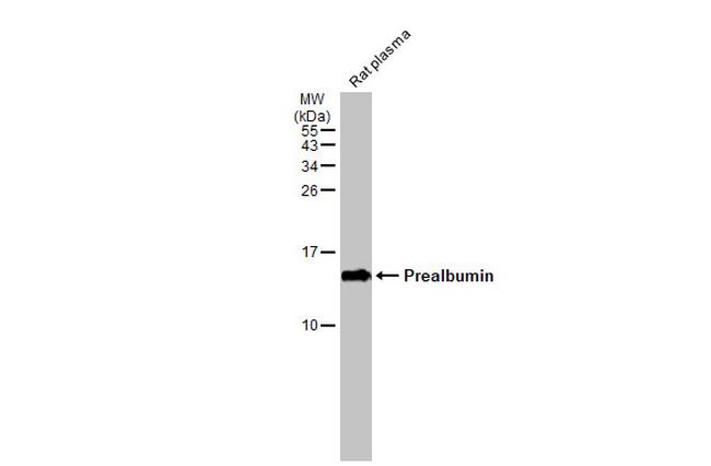 Transthyretin Antibody in Western Blot (WB)