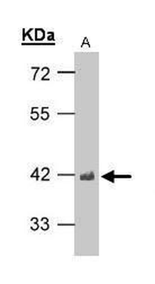 TDP-43 Antibody in Western Blot (WB)