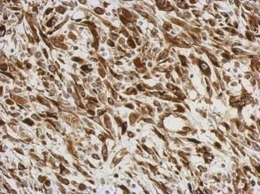 AGR3 Antibody in Immunohistochemistry (Paraffin) (IHC (P))