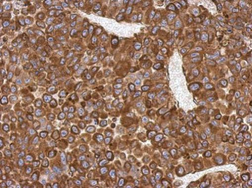 AGR3 Antibody in Immunohistochemistry (Paraffin) (IHC (P))