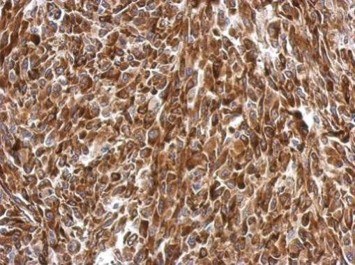 AGR3 Antibody in Immunohistochemistry (Paraffin) (IHC (P))