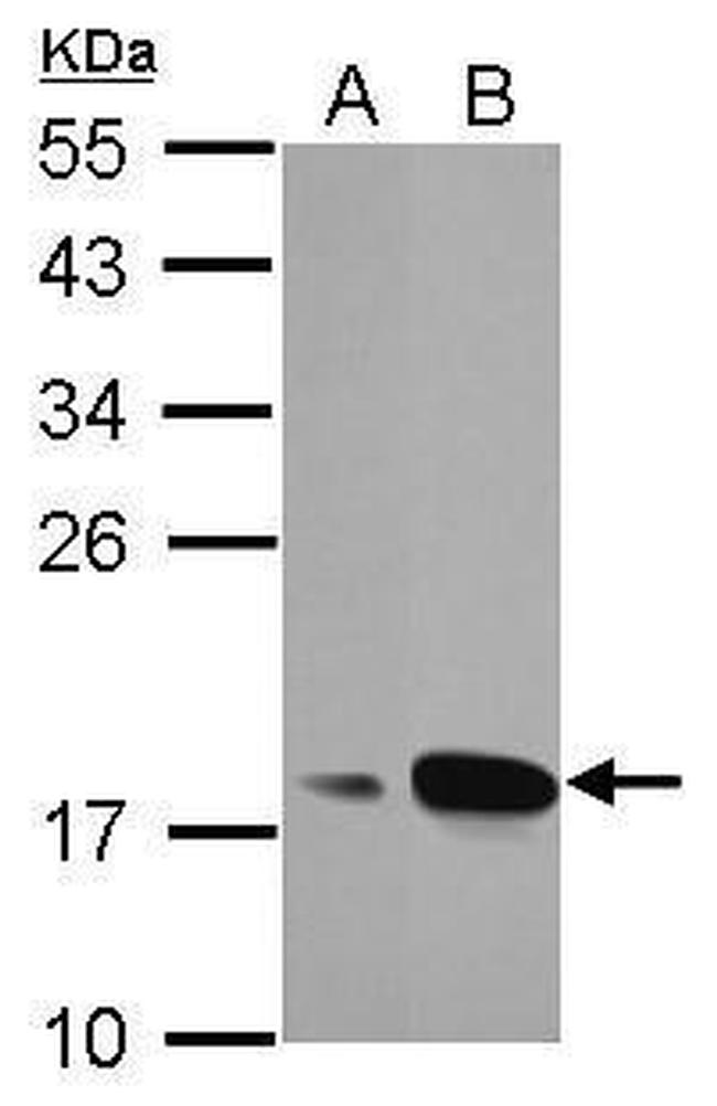 AGR3 Antibody in Western Blot (WB)