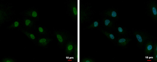 UBE2C Antibody in Immunocytochemistry (ICC/IF)