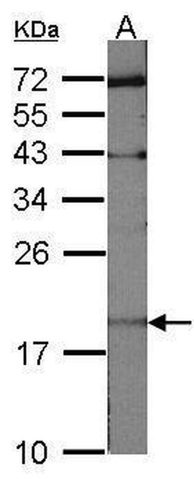 UBE2C Antibody in Western Blot (WB)