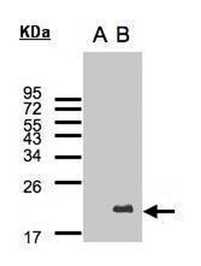 UBE2C Antibody in Western Blot (WB)